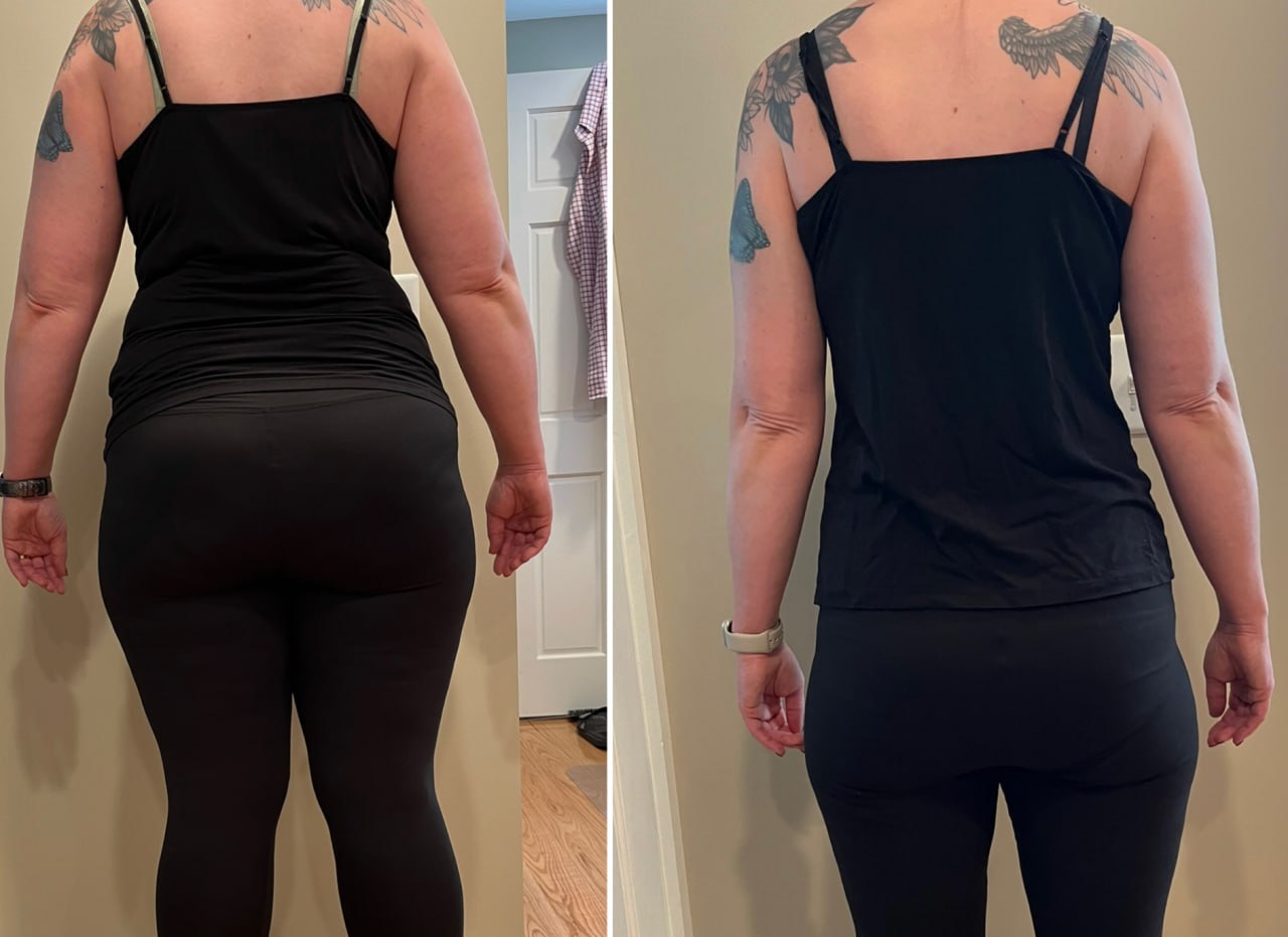 Weight loss before and after back view at Skin Solution MedSpa