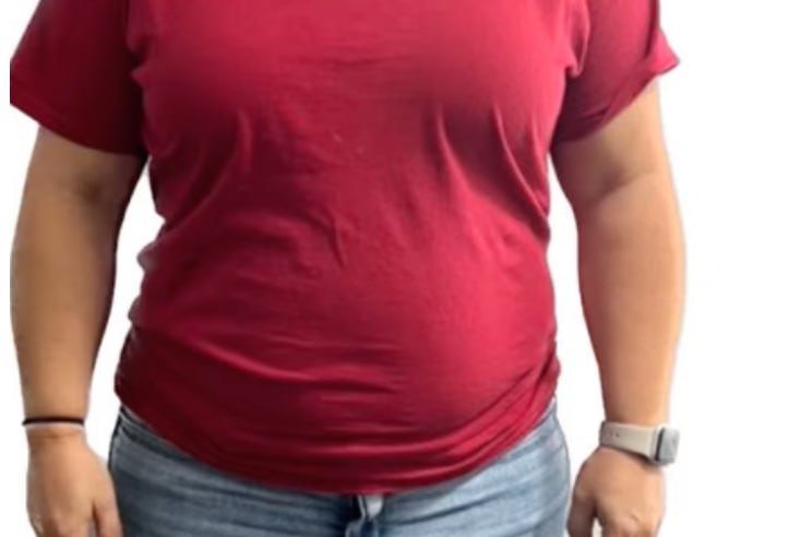 Weight loss before at Skin Solution MedSpa