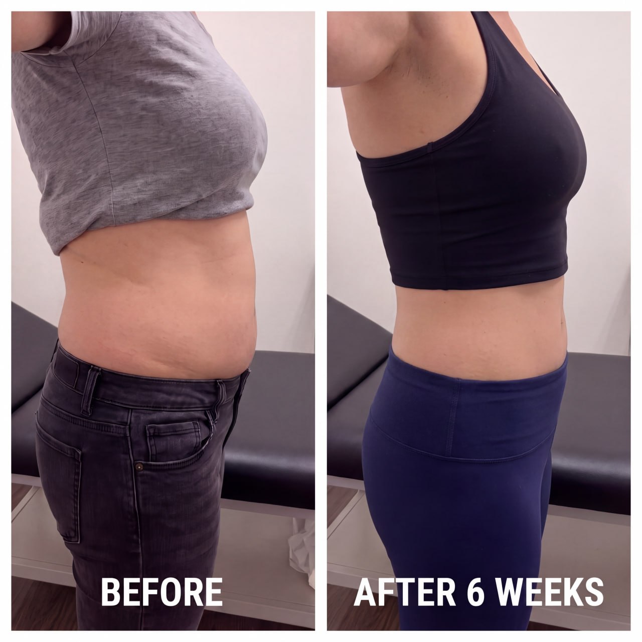 Body sculpting before and after - 6 week results